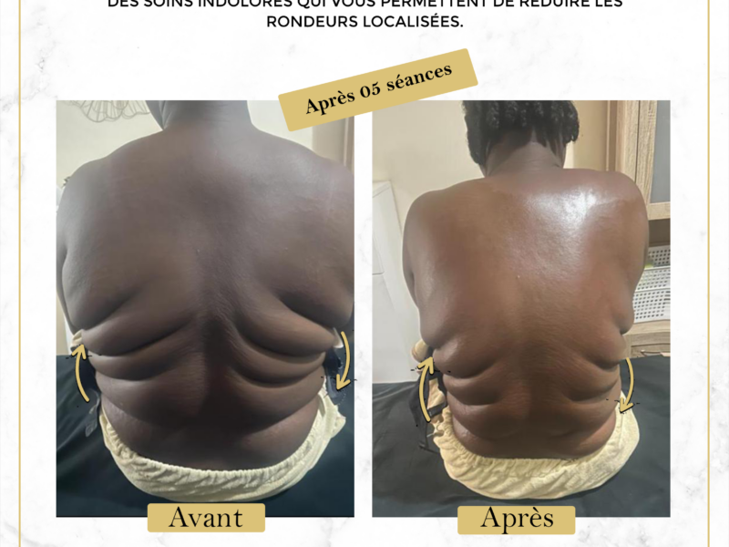 Affinez Votre Silhouette