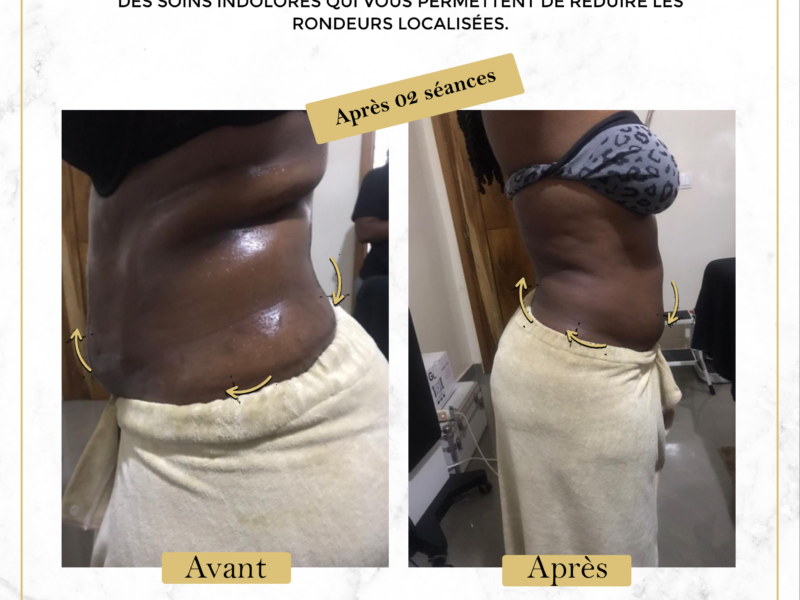 Affinez Votre Silhouette
