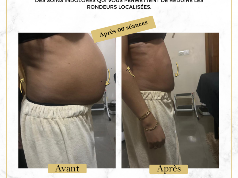 Affinez Votre Silhouette